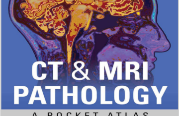 CT & MRI Pathology: A Pocket Atlas, Third Edition 3rd Edition By Michael Grey eBook cover